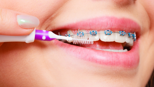 Зубной ершик Зубной ершик